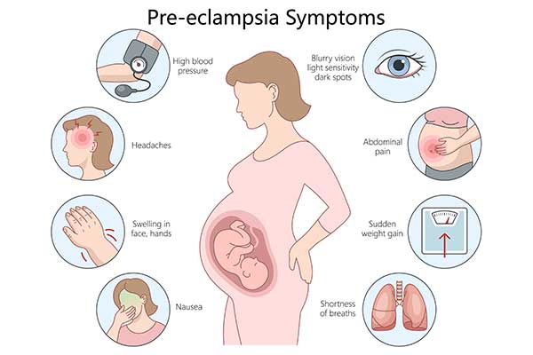 Preeclampsia Symptoms